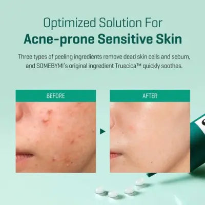 SOME BY MI: AHA.BHA.PHA 14 DAYS Super Miracle Spot All Kill Cream