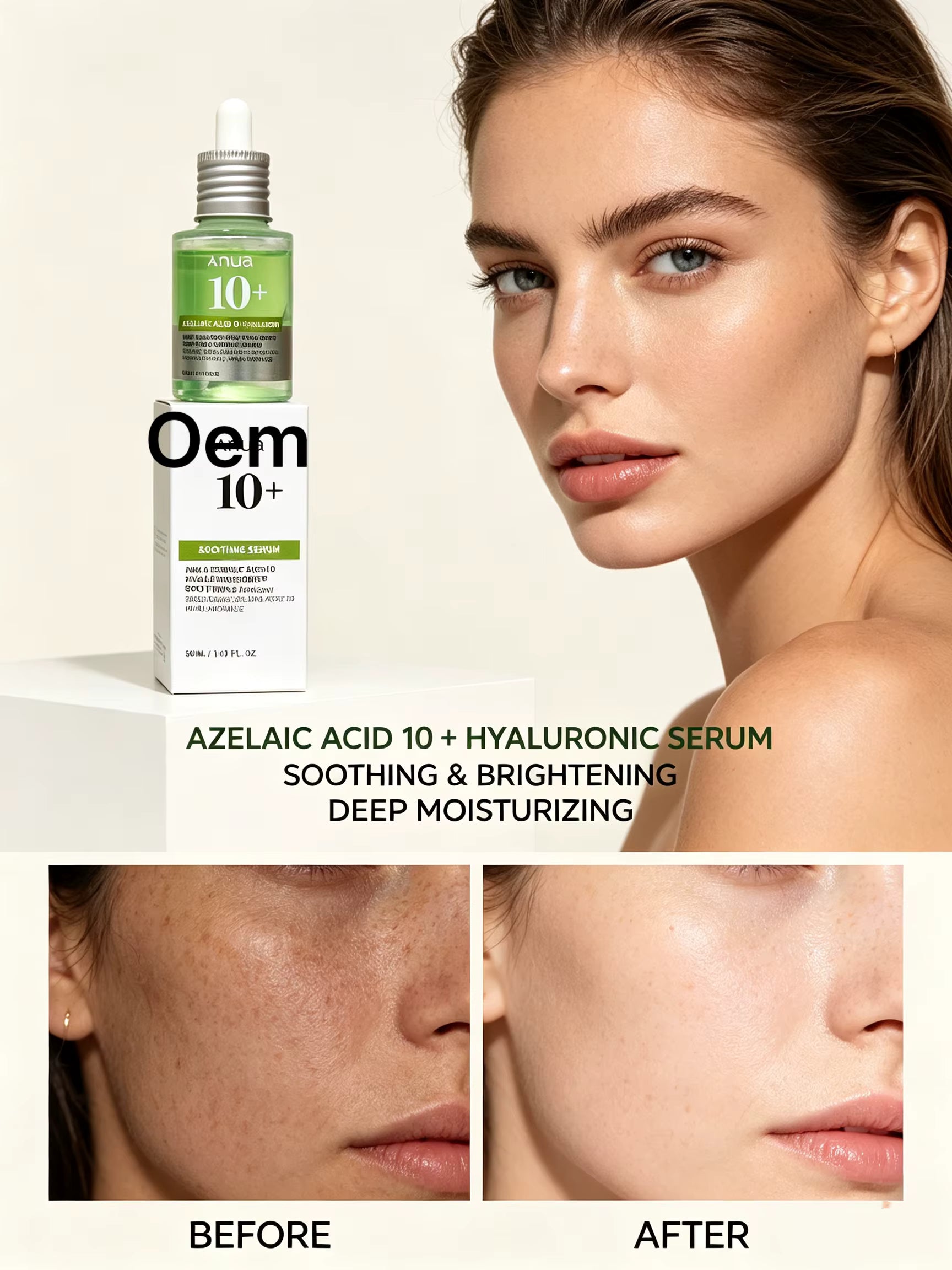 Anua Azelaic Acid 10 + Hyaluron Redness Soothing Serum | سيروم أنوا لتهدئة احمرار البشرة