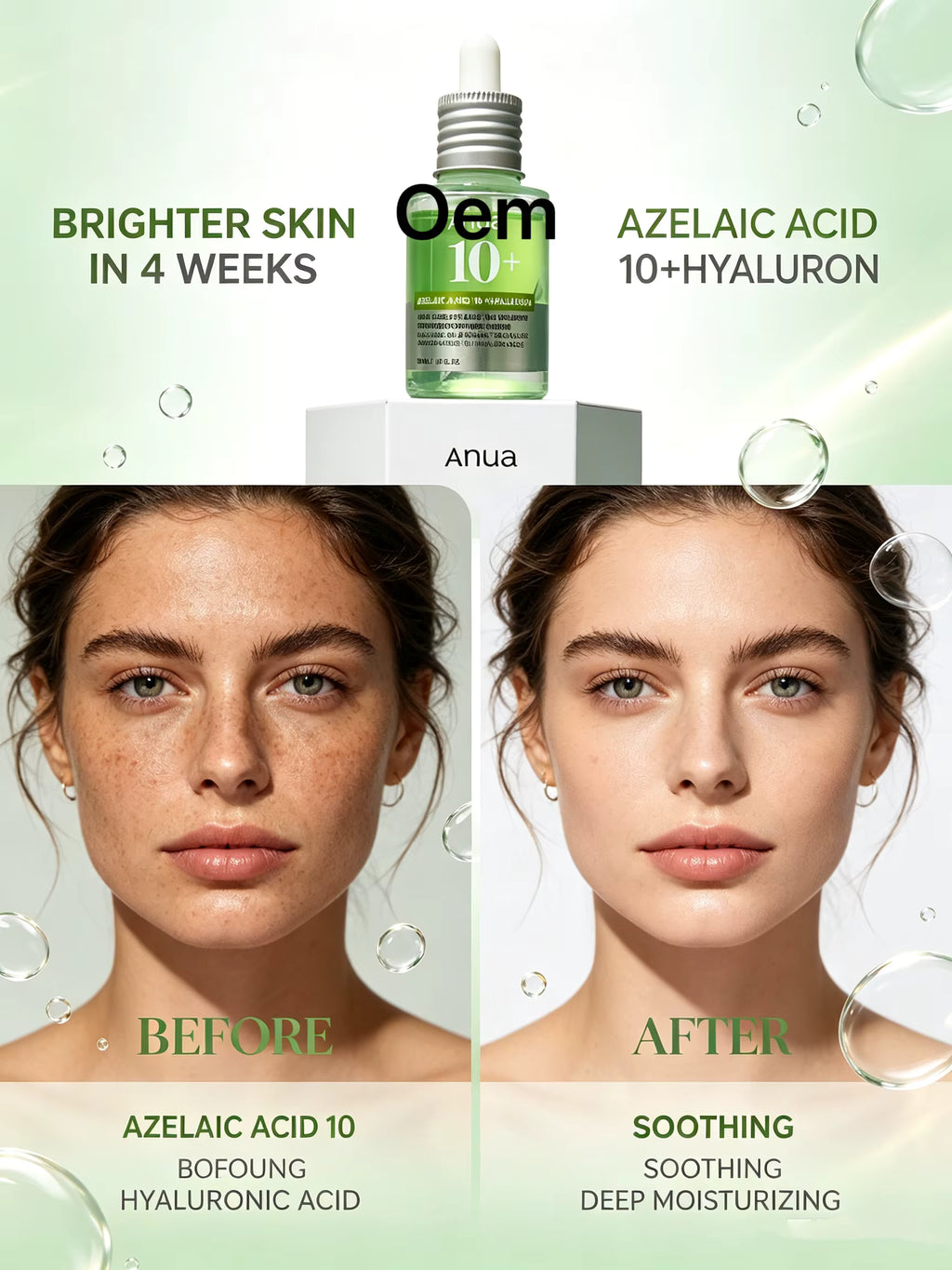 Anua Azelaic Acid 10 + Hyaluron Redness Soothing Serum | سيروم أنوا لتهدئة احمرار البشرة