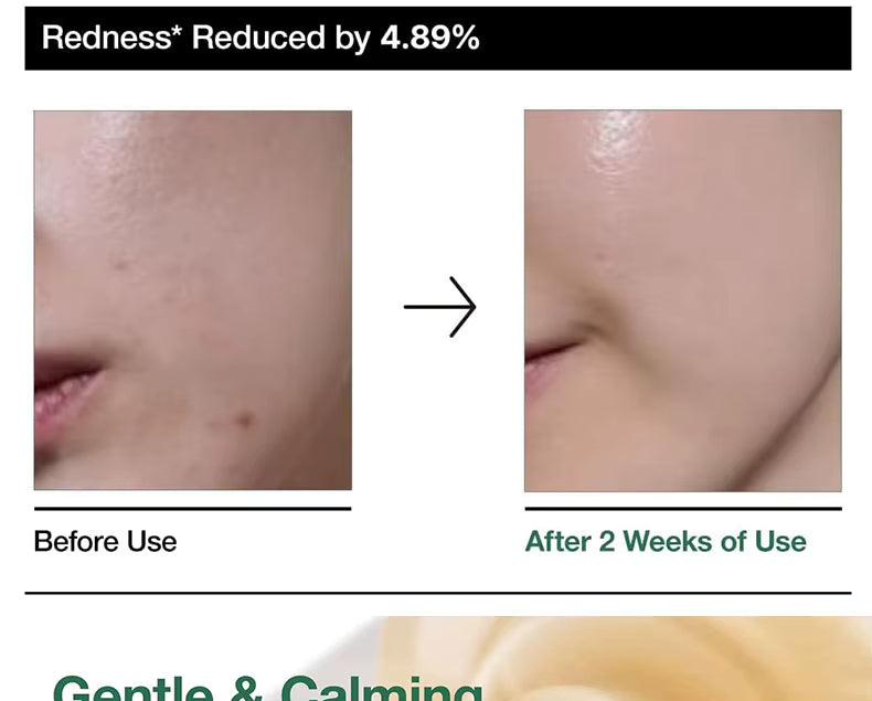 Anua Heartleaf 80 Moisture Soothing Ampoule | أمبولة أنوا هارت ليف 80% للتهدئة والترطيب