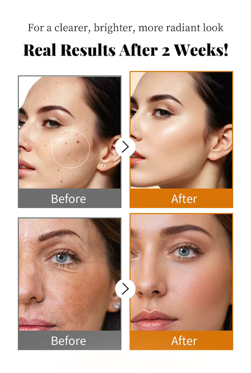 Anua Azelaic Acid 10 + Hyaluron Redness Soothing Serum | سيروم أنوا لتهدئة احمرار البشرة